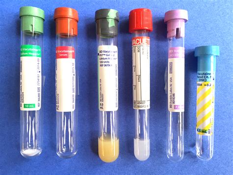 thick white substance test tube|white clump in blood tube.